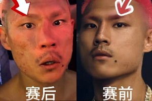 慘遭“整容”！惡鼠遭威姆斯TKO 鼻梁骨被打歪鮮血直流??