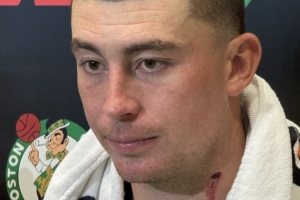 頸部有明顯血痕！普理查德：訓(xùn)練營(yíng)里的對(duì)抗像打仗一樣