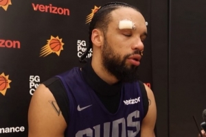 是誰干的？狄龍：訓(xùn)練中被隊友用肘部撞到了額頭 我縫了六針