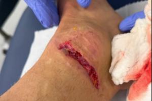 慎入！迪涅腳踝被踩而裁判無表示，換下后怒踢座椅找四官泰勒理論