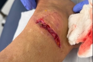 丹索：迪涅在場邊我向他道了歉，確實(shí)碰到了他，但我明顯先清了球