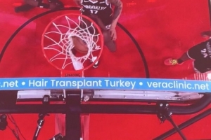 問(wèn)啥詹姆斯！NBA籃板上沿有土耳其植發(fā)公司廣告 手動(dòng)@杰倫-布朗